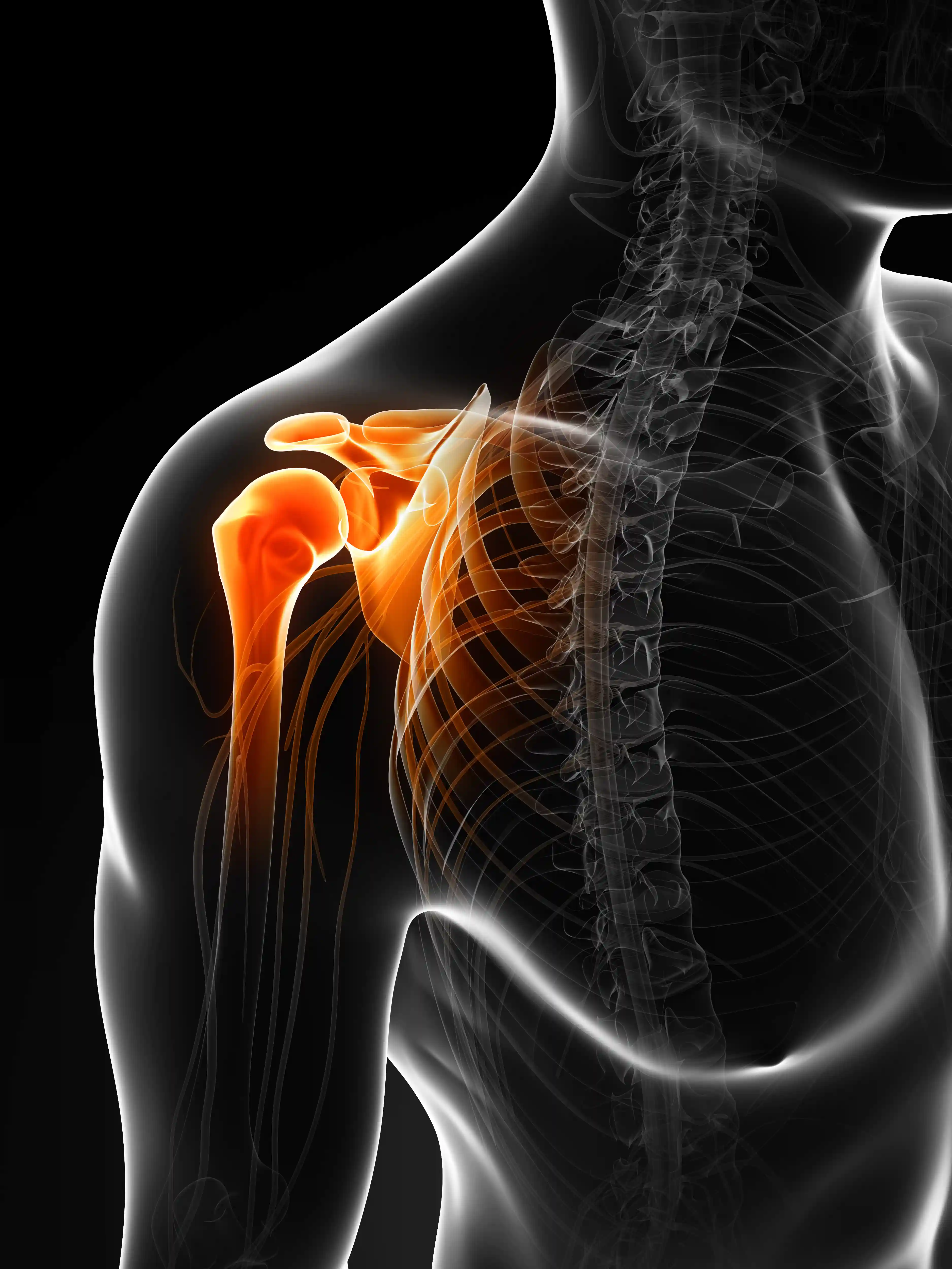 Shoulder Arthroscopy